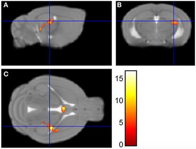Reduced Hippocampal Volume and Neurochemical Response to Adult Stress Exposure in a Female Mouse Model of Urogenital Hypersensitivity